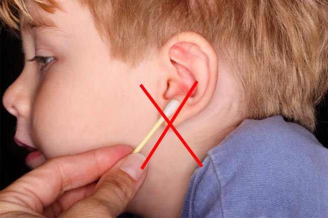 Most cases of ear wax blockage respond to home 
